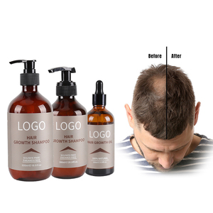 Productos para el cuidado del cabello de etiqueta privada Biotina, tratamiento anticaída, aceite para el crecimiento del cabello - Product Image 1