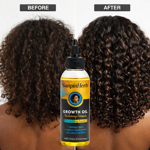 Aceite de Romero para el Crecimiento del Cabello Afro, Tratamiento para el Cuero Cabelludo, Hidratante, Reparador, Anti-Rotura, Marca Privada, Suministro al por Mayor - Product Image 3