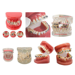 Hars tandmodel tanden onderwijs tandheelkunde studie verwijderbare orthodontische implantaat praktijk training opleiding - Product Image 5