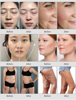 Appareil portable 6 en 1 pour le raffermissement et le rajeunissement de la peau du visage par aspiration 40k R&F et la lipocavitation corporelle