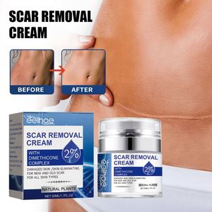 <span class=keywords><strong>Crema</strong></span> Reparadora de Cicatrices EELHOE, Hidratante y Suavizante de la Piel con <span class=keywords><strong>Aloe</strong></span> <span class=keywords><strong>Vera</strong></span>, Desvanece Cicatrices de <span class=keywords><strong>Embarazo</strong></span> y Quirúrgicas, Antiarrugas para el Cuerpo de la Mujer - Product Image 3