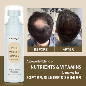 El fabricante protege el cuero cabelludo e hidrata la pérdida de reparación del cabello puntas abiertas crecimiento del cabello cuero cabelludo cabello arroz agua crecimiento Spray - Product Image 2