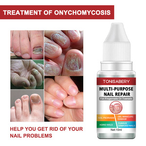 Nhãn hiệu riêng tonisabery ngón tay ngón chân móng tay sửa chữa móng tay giải pháp kháng khuẩn diệt nấm nấm móng điều trị chăm sóc móng tay - Product Image 2