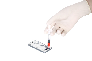 Analyseur de biochimie et d'électrolyte de gaz du sang de 34 paramètres secs automatisés pour l'usage de vétérinaire humain - Product Image 2