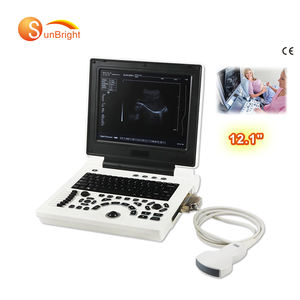 SUN-806H penggunaan medis rumah sakit Harga Murah perangkat ultrasonik penggunaan manusia laptop - Product Image 1