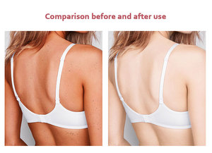 Papaya Set per la cura della pelle incandescente e forte sbiancamento <span class=keywords><strong>serie</strong></span> Kit di riparazione della pelle nera Set per la cura della pelle etichetta privata - Product Image 6