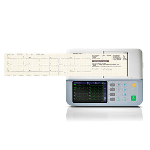 Monitor Veterinario Portátil Mindray BeneHeart R3, Ligero, para Diagnóstico Cardíaco en Animales Pequeños y Grandes - Product Image 2