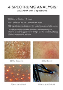 Hd Hair Follicles Scalp Scanner Detector Hair <span class=keywords><strong>Analyzer</strong></span> / Skin Scalp Hair Analysis Machine Metal/<span class=keywords><strong>PC</strong></span>/ABS Multifuncional Portátil - Product Image 5