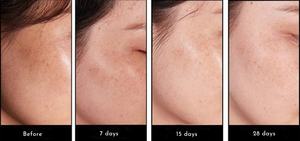 Producto para el Cuidado de la Piel con Espículas de Esponja, en Oferta, para Centros de Belleza, Polvo de Esponja, Ingredientes Naturales para el Cuidado de la Piel - Product Image 6