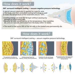 Máy làm lạnh đông mỡ công nghệ Cool <span class=keywords><strong>tech</strong></span> Sculpting 360 với 6 đầu trị liệu, công nghệ Cryotherapy làm lạnh đông mỡ, loại bỏ mỡ thừa - Product Image 3