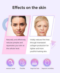 Dispositivo Eléctrico Profesional de Alta Frecuencia para Salón de Belleza, Varita de Electrodo de Vidrio, Varita de Terapia para la Piel para el Acné, Arrugas y Cuidado del Cabello 9 - Product Image 3