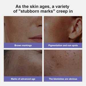 <span class=keywords><strong>Crema</strong></span> Facial Hidratante Blanqueadora con AHA Glicólico Orgánico Natural 50g, <span class=keywords><strong>Crema</strong></span> <span class=keywords><strong>de</strong></span> Belleza para Mujeres, Eliminador <span class=keywords><strong>de</strong></span> Manchas Oscuras y Antipigmentación - Product Image 5