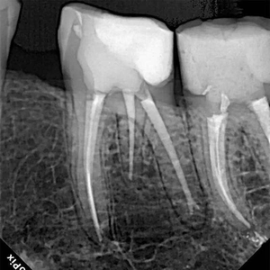 Capteur de radiographie portable avec zone active 24x33, interface USB sans fil, radiographie numérique RVG, capteur de radiographie - Product Image 4