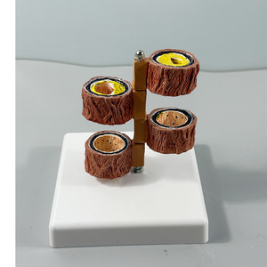 Model Anatomi Pembentukan Trombus Aterosklerosis Arteri Cabang Tubuh Manusia untuk Departemen Hematologi Vaskular Model LYA-002 - Product Image 2