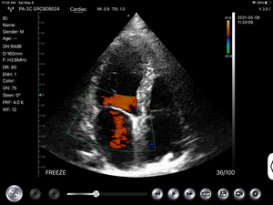 Cardíaco Doppler portátil de la máquina de ultrasonido precio médica <span class=keywords><strong>Sonar</strong></span> 2d 3d 4d ecocardiografía Ecografo Usd eco máquina - Product Image 5