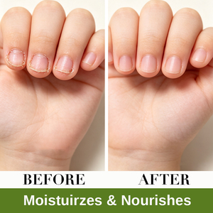 Ingredientes Herbales al por Mayor para Nutrir los Dedos y Prevenir la Adicción a la Costumbre <span class=keywords><strong>de</strong></span> Morder los Dedos en Niños - Product Image 2