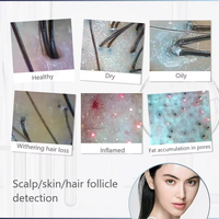 Nouveau modèle de scanner de cuir chevelu et d'analyseur capillaire avec grossissement 50x/200x pour l'épilation et les soins de la peau, usage domestique et commercial
