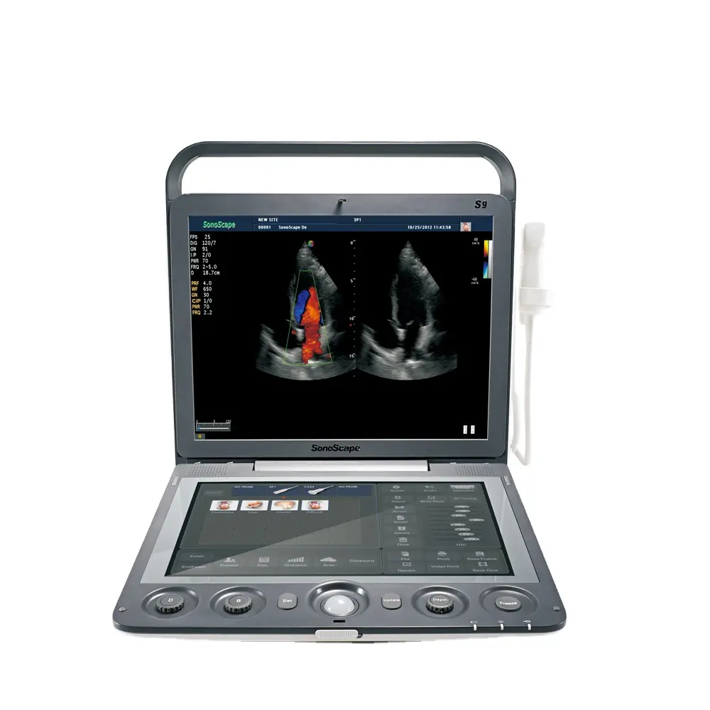 Beroemde Merk Sonoscape S9 3D 4D Draagbare Ultrasound Machine Prijs