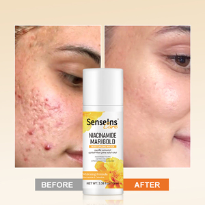 OEM/ODM toner viso Private label biologico sbiancante idratante rimuovere macchie scure niacinamide calendula idratante acqua - Product Image 6