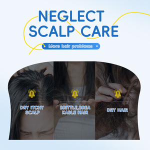 HUNMUI Siero per Capelli e Cuoio Capelluto al 3% <span class=keywords><strong>di</strong></span> Rosmarino, Roll-On con Aloe Vera e Olio <span class=keywords><strong>di</strong></span> Zenzero, Trattamento Anticaduta e Tonico Nutriente per le Radici - Product Image 4