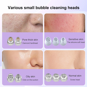 Máquina de Microdermoabrasión, Exfoliante Facial, Limpiador Profundo de Burbujas Pequeñas, Analizador de Piel Facial - Product Image 5