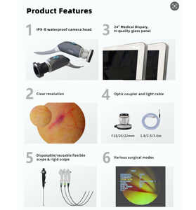 Juego de artroscopia de cistoscopio laparoscópico de 24 pulgadas Cámara endoscópica portátil Full HD 1080P para diagnóstico de cirugía - Product Image 5