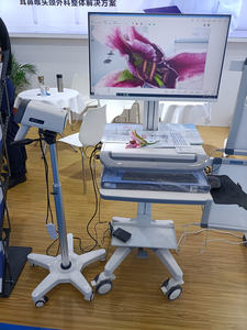 चिकित्सा एंडोस्कोप योनि कोलोस्कोपी डिजिटल कल्पना पोर्टेबल ट्रॉली कोलेपोस्कोप/स्त्री रोग ऑप्टिकल कोपोस्कोप - Product Image 2