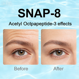 Matières premières cosmétiques, peptide anti-rides Snap-8, CAS 868844-74-0, acétyl octapeptide-3, poudre SNAP-8 - Product Image 3