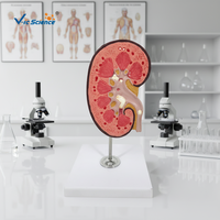 Modèle anatomique de rein avec glande suréchide en PVC, taille réelle 3X, 2 parties, pour la formation scientifique médicale dans les écoles