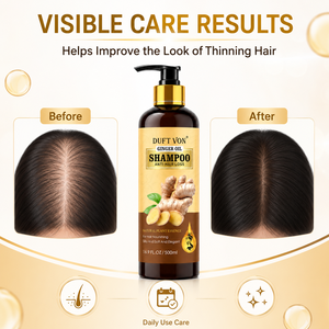 Shampoo allo Zenzero Personalizzato OEM Anticaduta, Essenza Naturale Vegetale, <span class=keywords><strong>Capelli</strong></span> Morbidi e Setosi, <span class=keywords><strong>Cura</strong></span> Profonda del Cuoio Capelluto, Riduce la <span class=keywords><strong>Caduta</strong></span>, 500ml - Product Image 2