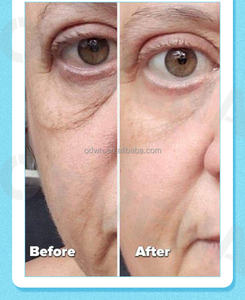 OTVENA Crème Contour des Yeux Bio Peptide <span class=keywords><strong>Anti</strong></span>-<span class=keywords><strong>Rides</strong></span> Enlever <span class=keywords><strong>les</strong></span> Poches Plus Jeunes <span class=keywords><strong>10</strong></span> Ans Crème Contour des Yeux Instantanée - Product Image 5