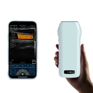 KONTED Máquina de ultrasonido portátil Wifi Color Doppler Escáner de ultrasonido inalámbrico Sonda de ultrasonido lineal de mano - Product Image 2