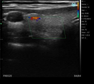 <span class=keywords><strong>Doppler</strong></span> warna 7.5-10mhz genggam nirkabel Probe Ultrasound Msk & vaskular - Product Image 4
