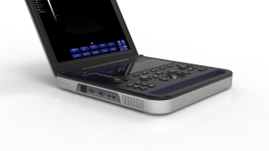 Harga Mesin USG Digital Portabel untuk Laptop, USG Domba, USG Sapi, dan Hewan - Product Image 5