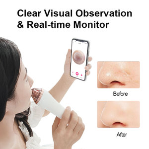 Electric Blackhead Remover With Wifi App <b>Wireless</b> <b>Camera</b> Observation Skin Care Tools Blackhead Remover Vacuum With <b>Camera</b> - Product Image 4