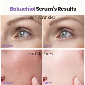 Suero Reafirmante de Bakuchiol de 30 ml de Marca Privada al por Mayor, Esencia Facial Antiarrugas y Antienvejecimiento, Alternativa al <span class=keywords><strong>Retinol</strong></span> para Pieles Sensibles - Product Image 4
