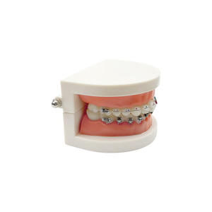 Modelo Anatómico de Ortodoncia con Autobloqueo 1/4, Soportes de Resina Plástica PVC, Modelos Dentales MX-070, Educación y Enseñanza al Paciente - Product Image 4