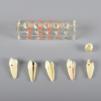 Modelo de estudio Dental, tratamiento endodontico, modelo de educación para pacientes
