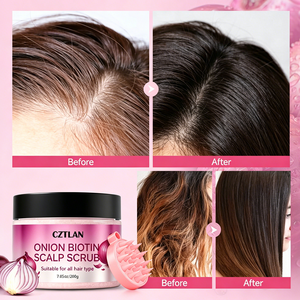 Gommage au sel exfoliant pour le cuir chevelu à l'oignon rouge et à la biotine, nourrissant les follicules pileux et fortifiant les racines, shampoing exfoliant pour le cuir chevelu en gros - Product Image 5