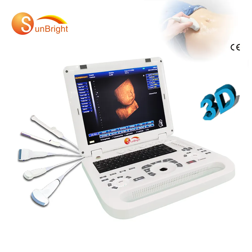 Tragbare 3D-Ultraschallmaschine Laptop Schwangerschaft GYN Ultraschall-Echo-Scanner