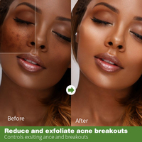 Sérum Visage Anti-Acné à l'Acide Salicylique OEM ODM : Contrôle Optimal, Inhibe les Boutons, Débouche et Répare les Pores