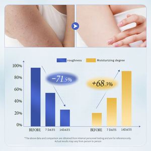 Lotion corporelle <span class=keywords><strong>éclaircissant</strong></span>e rapide RAMZER au <span class=keywords><strong>lait</strong></span> <span class=keywords><strong>de</strong></span> <span class=keywords><strong>coco</strong></span> et nicotinamide pour femme, hydratante et <span class=keywords><strong>éclaircissant</strong></span>e - Product Image 4