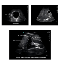 Simulateur d'entraînement à l'échographie du tronc complet EFAST TTE POCUS Phantom modulaire de pathologie remplaçable pour les écoles de médecine, les hôpitaux, OEM