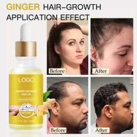 Huiles essentielles Anti-chute de cheveux et du cuir chevelu, pour La croissance des cheveux, pour La santé