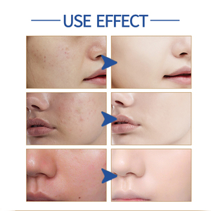 Sérum Visage Éclat Anti-Taches Acide Hyaluronique Marque Blanche OEM Soin Coréen Anti-Âge Hydratant - Product Image 4