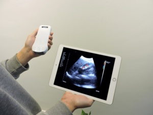 Konted MDR 3 in 1 Wireless convesso/lineare/ecografia cardiaca sonda Android Windows Scanner a ultrasuoni - Product Image 5