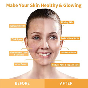 Prix de Gros Baume Visage à la Vitamine C Élimination du Mélasma Pigmentation Gel Éclaircissant <span class=keywords><strong>Anti</strong></span>-Âge Réduction des Rides Taches Brunes - Product Image 3