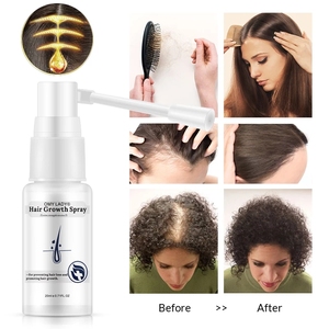 Spray per la Crescita dei <span class=keywords><strong>Capelli</strong></span> OMY LADY, Migliora e Previene la <span class=keywords><strong>Caduta</strong></span> dei <span class=keywords><strong>Capelli</strong></span>, Prodotti per Uomini e Donne - Product Image 5
