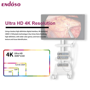 Sistema de cámara endoscópica de vídeo ENDOSO 4K Ultra HD con registro USB para artroscopia ENT laparoscopia histeroscopia toracoscopia - Product Image 5