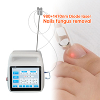 Endo Fiber Lift 980 Y 1470 Traitement de l'onychomycose et des mycoses des ongles et des pieds Autres produits de beauté et de soins personnels